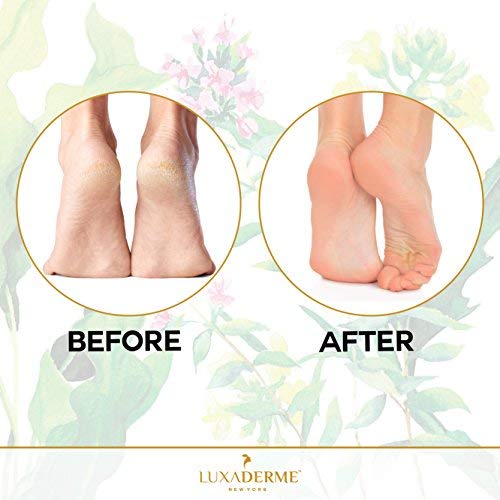 Luxaderme Foot Peel Mask & Exfoliating Foot Mask For Dry, Dead & Calloused Skin Removal. Repair Rough Heels For Baby Soft Feet. At-Home Pedicure. Contains Aha, Bha, 30+ Botanicals Like Rosemary, Jasmine & Lemon Balm. (Pack Of 2) #TOP4