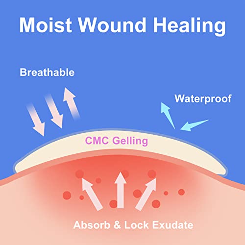 Niceful 15 Packs Hydrocolloid Bandages 4X4 In, Hydrocolloid Dressing Healing Bandages For Wounds, Waterproof Hydrocolloid Bandages Large #TOP3