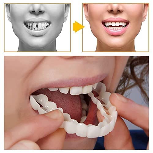 8 Pcs Denture Teeth Temporary Fake Teeth Snap On Veneers, Snap In Teeth For Men And Women, Dental Veneers For Temporary Teeth Restoration, Cover The Imperfect Teeth, No Pain No Shot No Drilling #TOP3