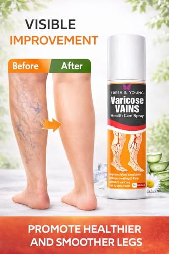 Image of Fresh & Young Varicose Veins Spray | Natural Formula for Fast Relief | Reduces Swelling, Relieves Pain & Improves Blood Circulation | Easy-to-Use Spray for Legs & Feet - 50 ml Pack of 3