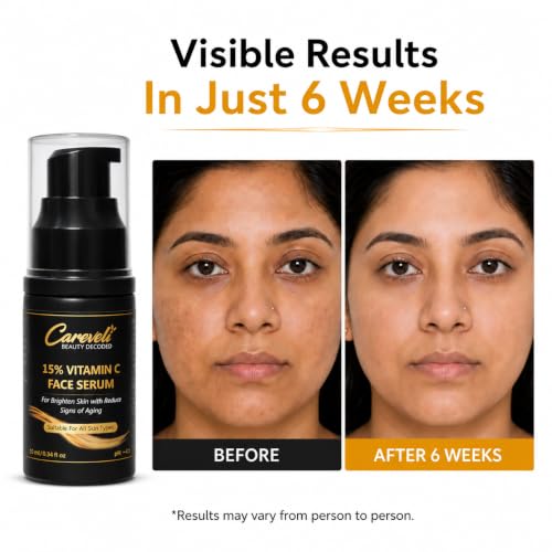 Image of 15% Vitamin C Face Serum with 5% Niacinamide, 1% Hyaluronic Acid, 0.5% Ferulic Acid & 0.1% Vitamin E | Face Serum for Glowing Skin, Dark Spots Appearance, Uneven Skin Tone & Hydration | Lightweight & Non-Sticky (10 ml)
