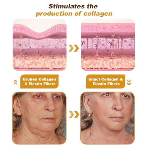 2025 New Bienengift-Faltenentfernungscreme,Bienengift Anti-Falten-Creme, Anti-Falten-Feuchtigkeitscreme für Gesicht und Hals, Bee Venom Anti-Falten-Creme für alle Hauttypen (1)