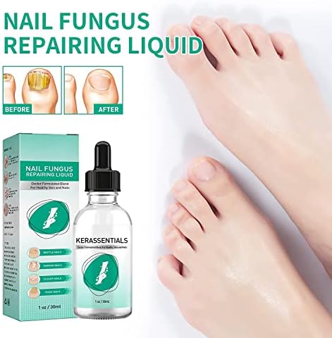 Kerassentials Toenail Fungus Treatment Oil, Kerassentials for Toenail Fungus,Kerasentials Nail Treatment,Kerassentials Healthy Skin (1pcs)