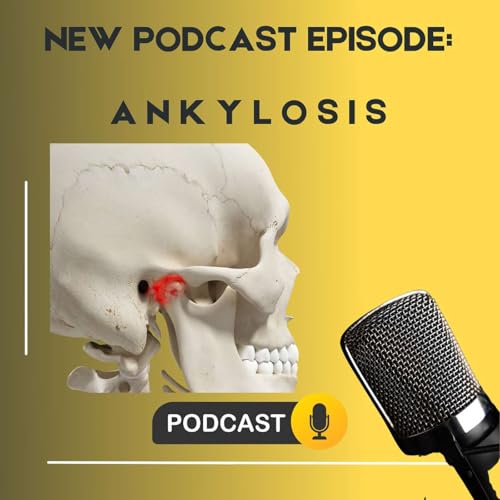 Ankylosis/stiffening and temporomandibular joint/TMJ