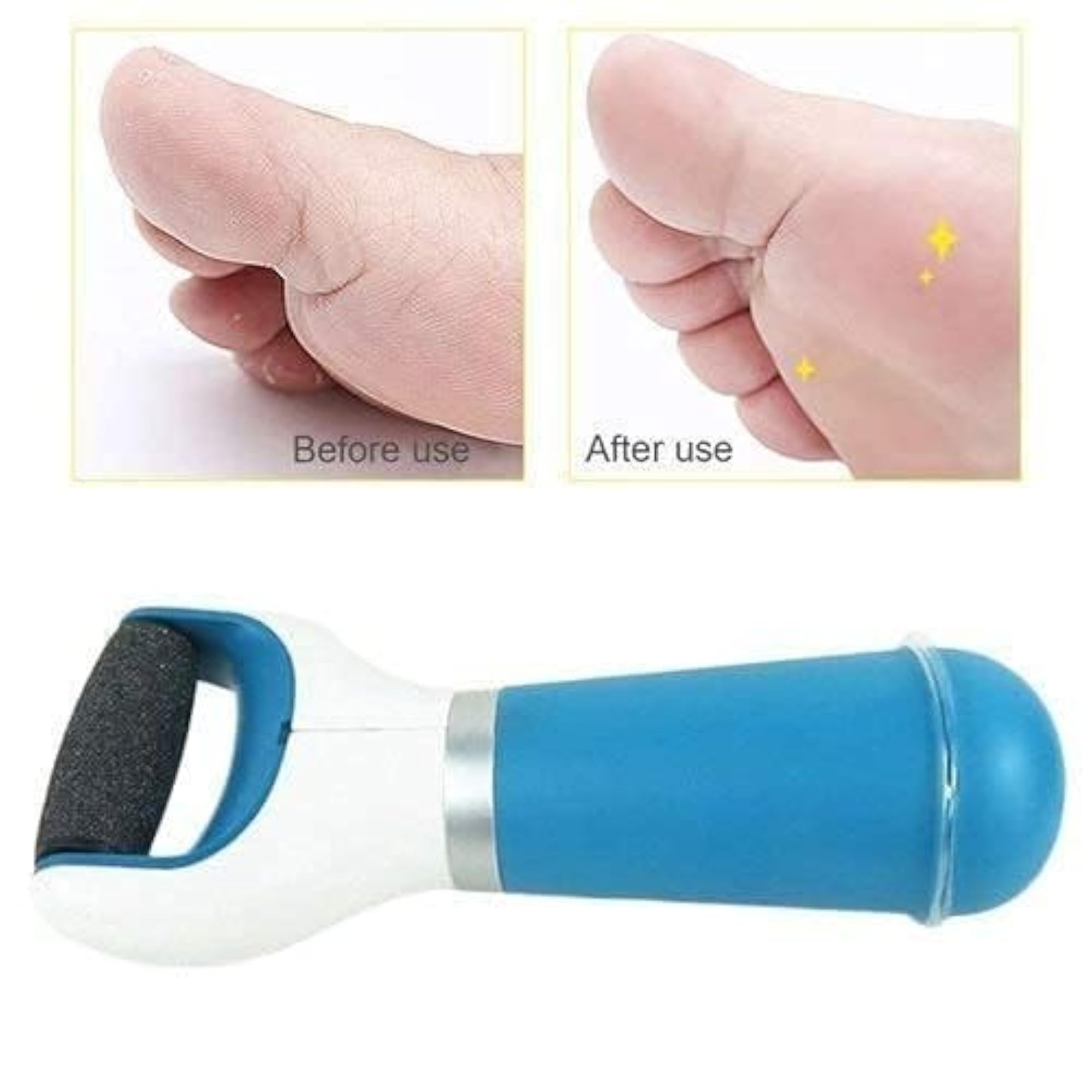 Foot Roller Callus Remover for Hard Skin
