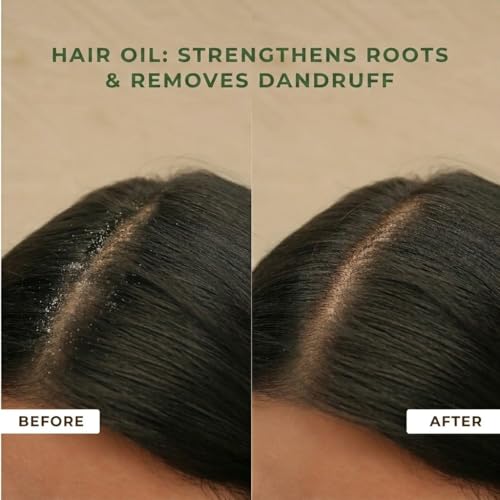 Image of Hair Oil and Serum Combo | Herbal Hair Care Kit (Hair Oil 100ML + Hair Serum 50ML) | Helps Improve Smoothness, Shine & Manageability | Non-Sticky Daily Use for Men & Women
