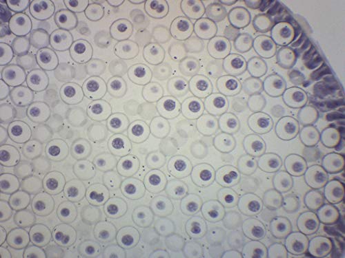 Image of EISCO Ascaris & Onion Mitosis, Prepared Microscope Slide - 75 x 25mm - Plant & Animal Mitosis, Introductory Microscopy
