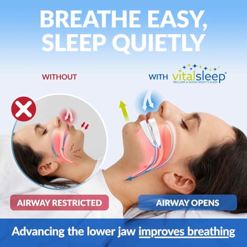 Anti Snoring Device by VitalSleep, Women\'s Size Snoring Solution, Personalized Snoring Mouth Guard, Adjustable Night Guard for Snoring, Comfortable Mouth Guard for Snoring - Made in USA - Thumbnail 4