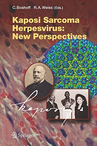 Kaposi Sarcoma Herpesvirus: New Perspectives (Current Topics in Microbiology and Immunology Book 312)
