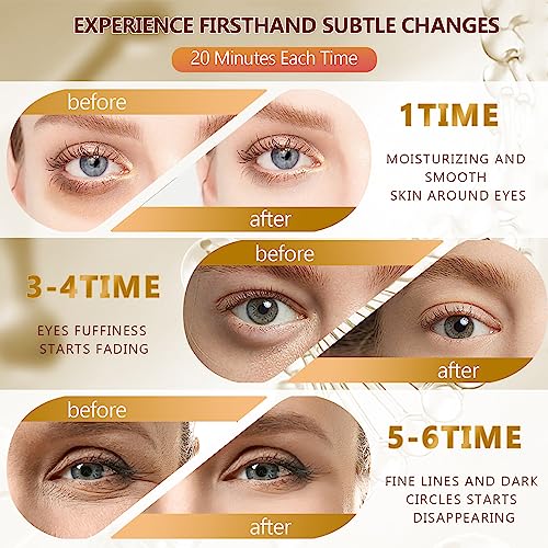 Yargkos 60 Pcs 24K Gold Under Eye Patches, 30 Pairs Undereye Mask for Dark Circles Puffy Eyes Treatment, Collagen Gel Pads Hydrating for Eye Bags Puffiness Wrinkle, Women Men Beauty Skin Care Products