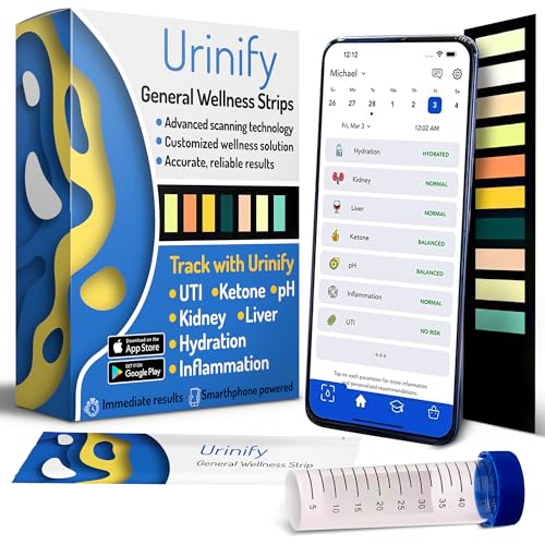 10 Best Home Urinalysis Tests for Accurate and Private Health