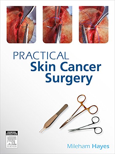 Practical Skin Cancer Surgery Kindle Edition By Hayes Mileham Professional Technical Kindle Ebooks Amazon Com
