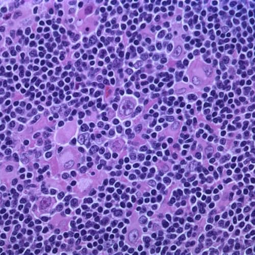 Ancient Dinosaur Fossil Alters Evolution Timeline, Mitochondria Regulate Energy and Death, Fiber-Photon Source Transforms Quantum Communication, Cancer Hijacks Embryonic Programs, and more...