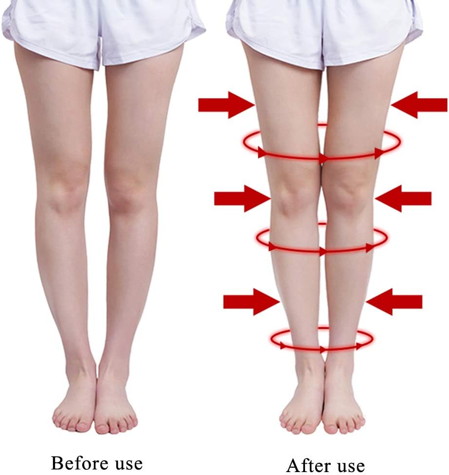 Lncpda Leg Correction Peripherique Jambe De Type O X Jambes Arquees Genou Valgum Redressage Correction Ceintures Bande Posture Correcteur Taille Universelle C Amazon Fr Hygiene Et Sante