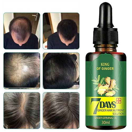 Ginger Germinal Oil Hair Growth 7 Day, Regrow 7 Day Ginger Germinal Hair Growth Serum Hairdressing Oil Hair Relief, Healthier Hair