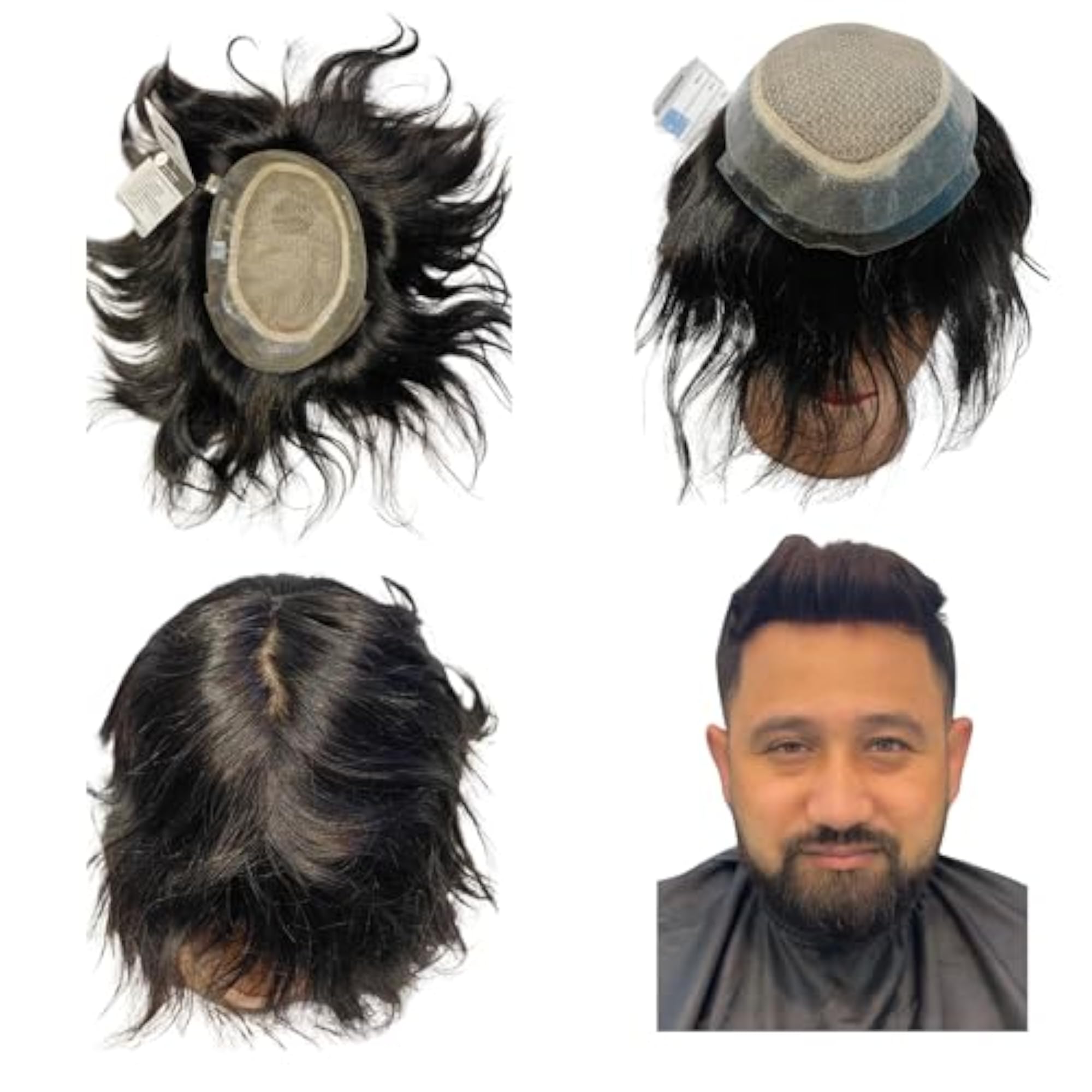 Australian Mirage Patch, Natural-Looking Non-Surgical System