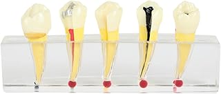 Axis Scientific Dental Pulp Repair Anatomy Model