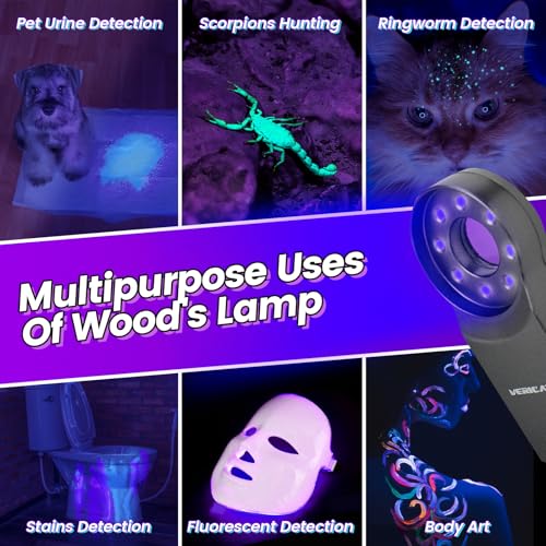 Image of Woods Lamp with Magnifying Glass, Rechargeable UV Flashlight Skin Analyzer, 365nm Ultraviolet Light LED Black Light for Pet Cat Urine Detection, Resin Curing, Cat Dog Ringworm