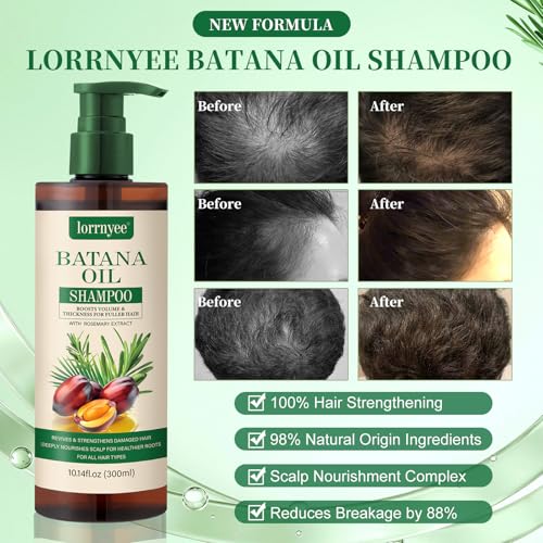 Image of Batana Oil Shampoo, Hair Growth Shampoo for Thinning Hair & Hair Loss Treatment - Organic Rosemary, Formula with Biotin & Keratin to Reduce Shedding, Thicken Hair For Men & Women 2 Pack
