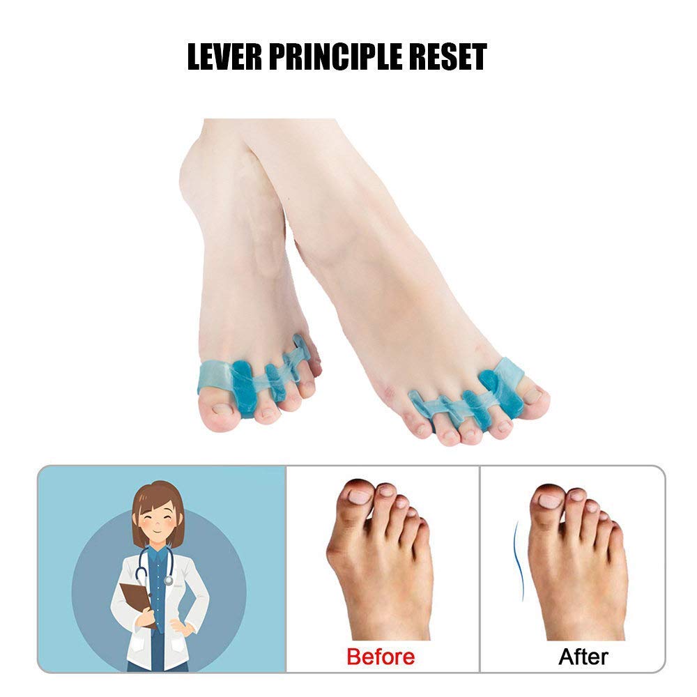 Korektor i ulga, silikonowy rozpieracz palców u stóp na hallux valgus, ochraniacz na halluxy, separator palców u stóp na ból stóp, przeciw halluxom valgus i nakładaniu si
