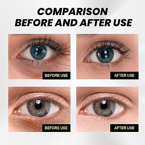 Celyn instant eye tightener,cëlyn instant firmx eye tightener,Lnstant Eye Tightener, Reduce Eye Bags, Puffiness, Anti-Aging Eye Cream for All Skin (1PC)