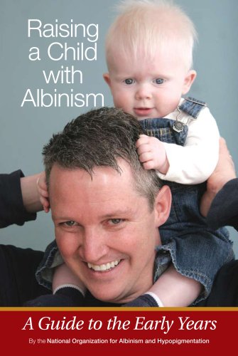 Raising a Child with Albinism: A Guide to the Early Years