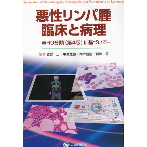 無料電子書籍 おすすめ 悪性リンパ腫・臨床と病理―WHO分類(第4版)に基づいて バイ