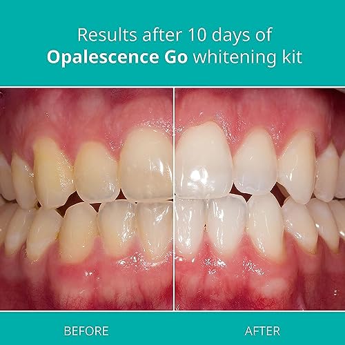 Opalescence Go 15% -Bonus Whitening Bundle With Mint Flavored Tooth Polish #TOP4