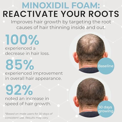 Image of Remixidil Men's 5% Minoxidil Foam Hair Regrowth Treatment for Men, 3 Month