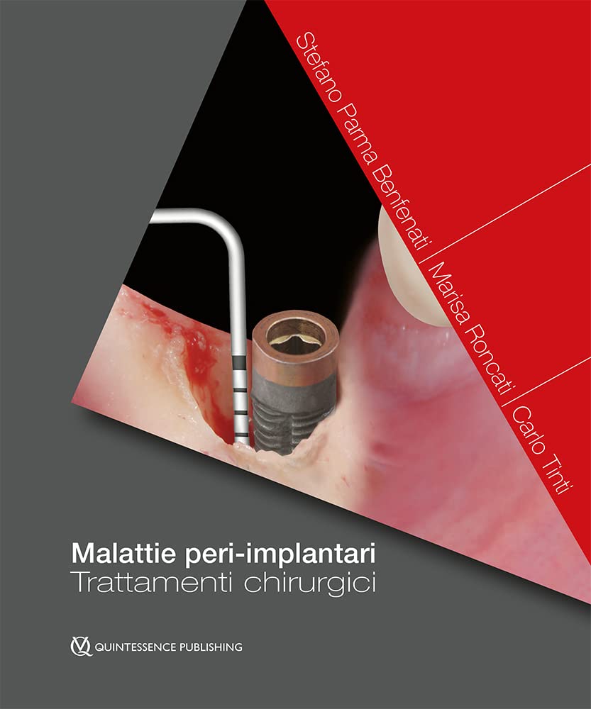 Malattie peri-implantari. Trattamenti chirurgici