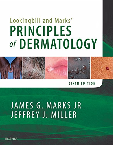 Lookingbill and Marks' Principles of Dermatology E-Book Lookingbill and Marks' Principles of Dermatology E-Book
