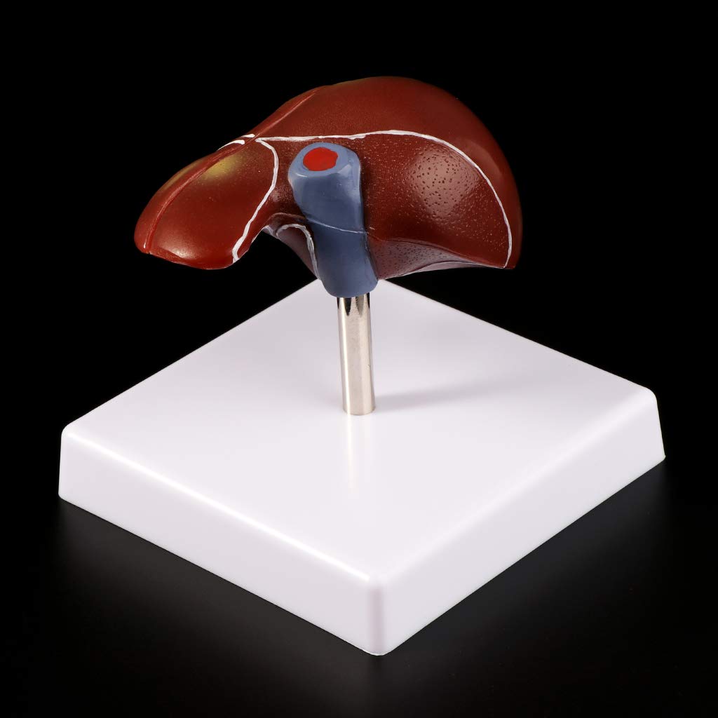 Modelo anatómico patológico del hígado humano, anatomía, escuela, enseñanza, displa
