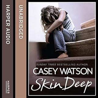 Skin Deep Audiobook By Casey Watson cover art