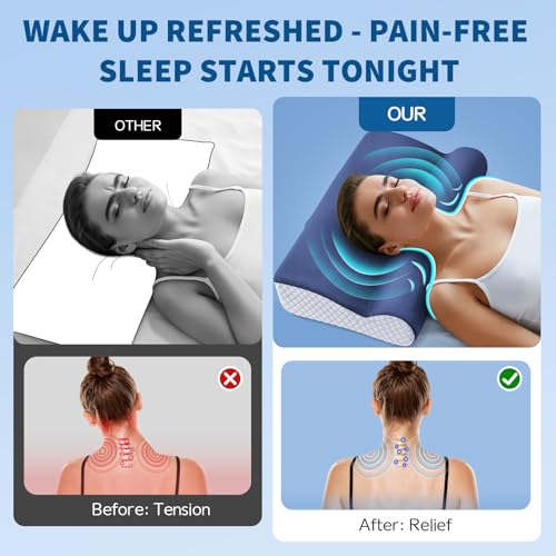 Orthopedic Cervical Memory Foam Pillow For Neck & Shoulder Pain Relief - Contour Neck Support With Neck Roll, Ergonomic Dual-Height For Side/Back Sleepers, Cooling Washable Cover - 100-Night Trial - 4