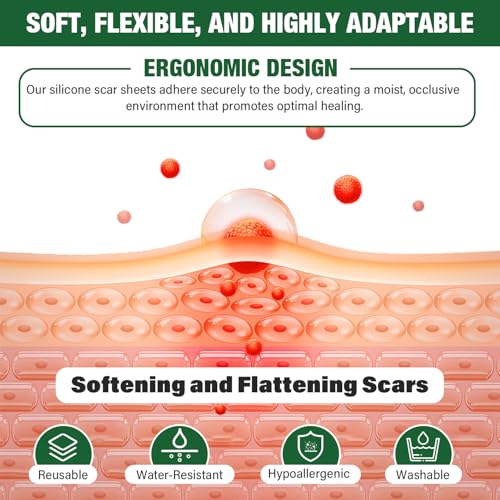 Micakin SHEETS-3-1 Silicone Scar Sheets,Silicone Scar Tape,Silicone Sheets thumb #3