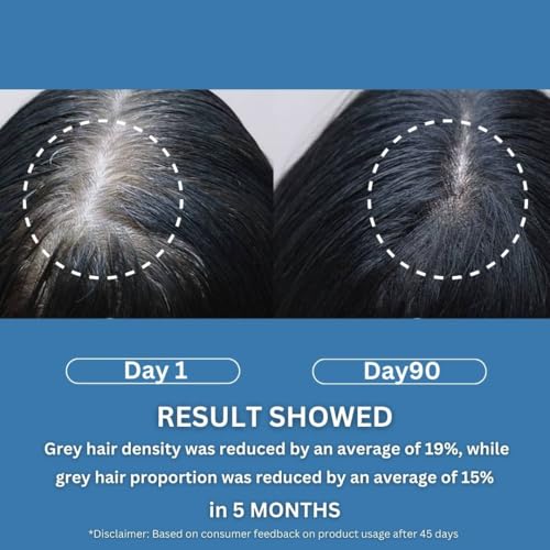 Image of 2% Darkenyl for Anti Grey Hair Serum|Anti-Greying Actives with Biotin, Bhringraj, Henna & Amino Acid Complex|Strengthens Roots & Adds Shine|Toxin Free|All Hair Types- 30ml