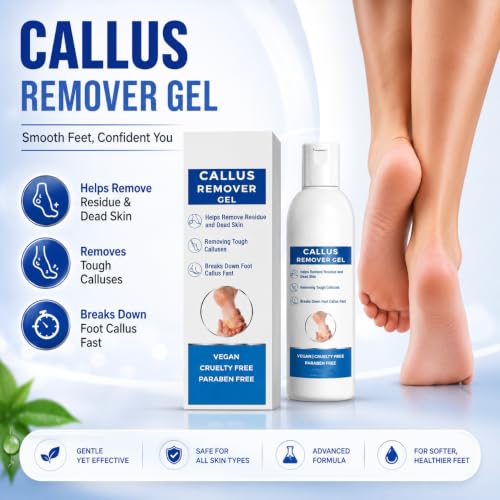 Image of Callus Remover Gel for Feet, Softening and Exfoliating Formula, Dry Rough Skin Care, 200ml, for Men and Women (1)