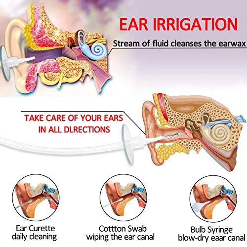 Ear Wax Removal Kit, Angela&Alex Ear Wax Cleaning Tool Including Ear