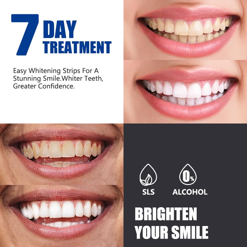 Image of Teeth Whitening Strips -14 Strips 7-Day Treatment Mint Teeth Whitener Kit for Coffee, Wine, Tobacco, and Other Stains 14 Count (Pack of 1), Mint