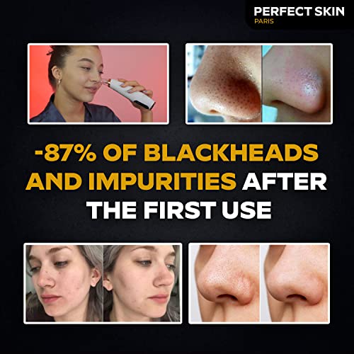 PERFECT SKIN PARIS®, Rimuovi punti neri, 2 anni di...