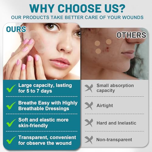 Image of Hydrocolloid Patch Large Pimple Patches for Face 3pcs 0.73in*75in Hydrocolloid Bandages Big Acne Patches Hydrocolloid Roll for Wound Care Hydrocolloid Patch Bandages Waterproof