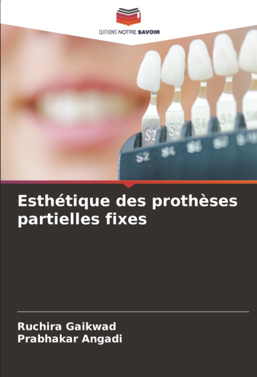 Esthétique des prothèses partielles fixes