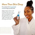 AcneFree Retinol Blemish Mark Resurfacing Serum with Hyaluronic Acid, and Niacinamide | Helps to Reduce the Appearance of Acne Marks | Redness Control | 1 Ounce - Image 4