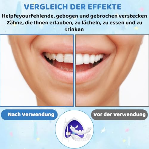 Zahnersatz Zum Aufstecken, Zähne Zum Aufstecken, 3 Stück Zahnprothesen, Temporärer Zahnersatz, Einfache Anwendung, Passgenaue Zahnlösung