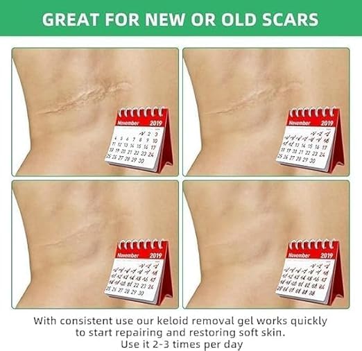 Image of Keloid & Scar Removal Gel - Advanced Silicone Scar Treatment Cream | Fades Acne, Surgery, Injury & Piercing Scars | Smoothens Skin, Reduces Bumps & Marks | 20g Scar Repair Solution (1)