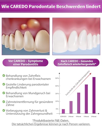 CAREDO Zahnpasta zur Behandlung von Parodontitis, Repariert Zahnfleischrückgang bei Erwachsenen, Hydroxyapatit-Zahnpasta, Fluoridfrei, Minzgeschmack, 100g Pro Tube – Bild 4