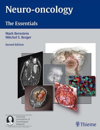 Buy Neuro-oncology: The Essentials — BookShops.in