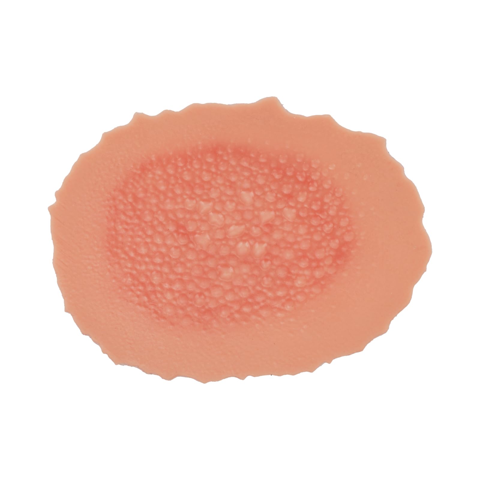 Burn Wound Model, Adhesive First Degree Burn Trainer