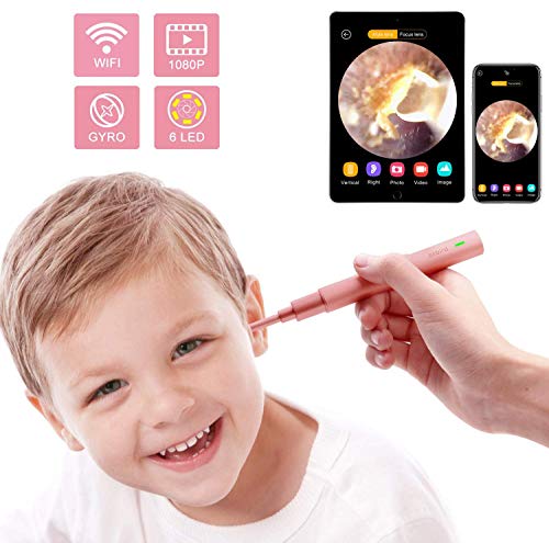 Ear Endoscope, 1080P Wireless Ear Wax Removal, Super Light Lens Earwax Cleaning Tool with 6 LED Lights, WiFi Ear Otoscope Camera with 3-Axis Gyroscope, Compatible with Smartphone & Tablet (Rose Gold)