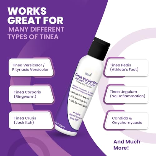 Image of Naturasil Tinea Versicolor Treatment Lotion - Max-Strength 10x Sulfur Lotion for Fast-Acting Antifungal Relief | Soothes and Restores Skin Health 113g
